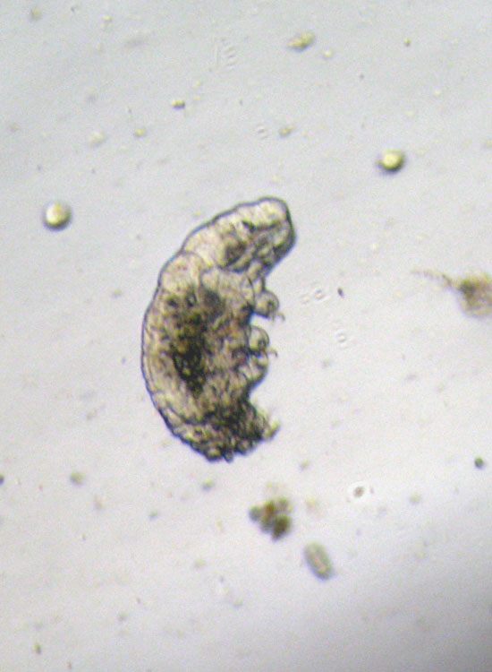 Tardigrado: probabile Macrobiotus richtersi